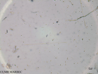 phyto/Brazilian_Nordeste/FernandodeNoronha_station42/ABRACOS2 April 2017/Thalassiothrix sp1 (ancien Synedra sp10-st42_Fmax_diatomee4 170821_001_ovl -2)(copy)_thumb.jpg